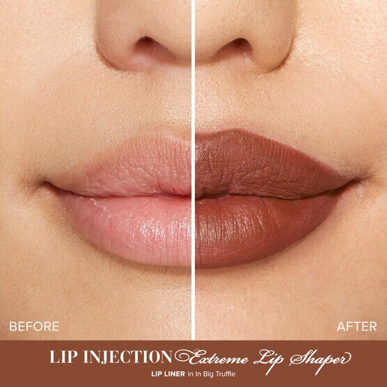 Lip Injection L�pis Boca In Big Truffle